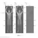 Fig. 08 - Body scanner with automated target recognition