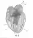 Fig. 03 - Model-based segmentation of an anatomical structure