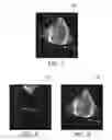 Fig. 06 - Model-based segmentation of an anatomical structure
