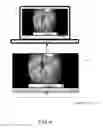 Fig. 06 - Systems and methods for observing and analyzing swallowing