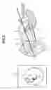 Fig. 06 - Medical image processing apparatus