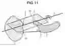 Fig. 09 - Medical image processing apparatus