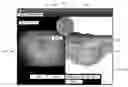 Fig. 01 - Graphic overlay for measuring dimensions of features using a video inspection device