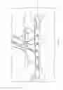 Fig. 03 - Detachable bridge for stringed instrument