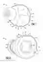 Fig. 02 - EARPIECE SYSTEM