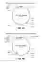 Fig. 02 - ANIMAL MODEL FOR NEPHROPATHY AND AGENTS FOR TREATING THE SAME