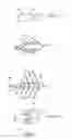 Fig. 02 - FISH CAPTURE DEVICE WITH RELEASE MECHANISM