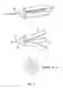 Fig. 06 - FISH CAPTURE DEVICE WITH RELEASE MECHANISM