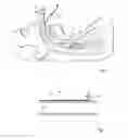 Fig. 02 - Airway maintenance device
