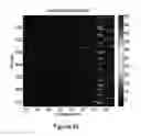 Fig. 07 - System and method for measuring physiologically relevant motion