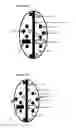 Fig. 08 - Devices for testing distal colonic and anorectal function