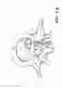 Fig. 05 - APPARATUS FOR THE TREATMENT OF TISSUE