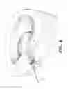 Fig. 11 - APPARATUS FOR THE TREATMENT OF TISSUE