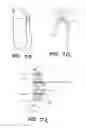 Fig. 12 - APPARATUS FOR THE TREATMENT OF TISSUE
