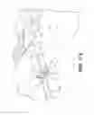 Fig. 18 - APPARATUS FOR THE TREATMENT OF TISSUE