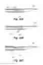 Fig. 33 - APPARATUS FOR THE TREATMENT OF TISSUE