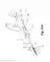 Fig. 35 - APPARATUS FOR THE TREATMENT OF TISSUE