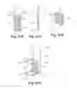 Fig. 44 - APPARATUS FOR THE TREATMENT OF TISSUE