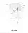 Fig. 52 - APPARATUS FOR THE TREATMENT OF TISSUE