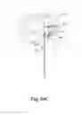 Fig. 53 - APPARATUS FOR THE TREATMENT OF TISSUE