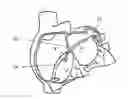 Fig. 01 - Method and system for closing left atrial appendage