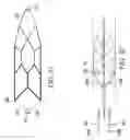 Fig. 69 - Clot retrieval system
