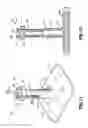 Fig. 08 - TROCAR TIP PROTECTOR