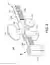Fig. 03 - Orthopedic compression/distraction device