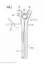 Fig. 03 - Medical instrumentation and method