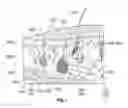 Fig. 02 - Systems and methods for creating an effect using microwave energy to specified tissue
