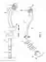 Fig. 02 - Apparatus and Method to Maintain Flow Through and Prevent Clogging of a Feeding Tube