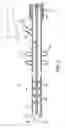 Fig. 03 - Apparatus and Method to Maintain Flow Through and Prevent Clogging of a Feeding Tube