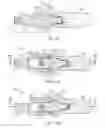 Fig. 09 - COMPONENTS FOR USE WITH IMPLANTS AND RELATED METHODS