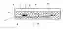 Fig. 01 - Device for supporting and transporting a graft or implant