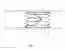 Fig. 02 - Vascular filter system