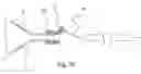 Fig. 09 - Vascular filter system