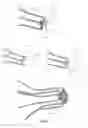 Fig. 28 - Vascular filter system