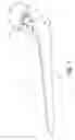Fig. 02 - Ceramic Spacer for the Two-Sided Replacement of Implants in Shoulder, Knee and Hip as a Result of Infections
