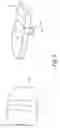 Fig. 07 - Ceramic Spacer for the Two-Sided Replacement of Implants in Shoulder, Knee and Hip as a Result of Infections