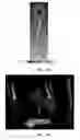 Fig. 85 - Hybrid surgical tracking system
