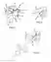 Fig. 02 - Cervical distraction/implant delivery device