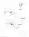 Fig. 06 - Cervical distraction/implant delivery device