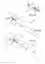 Fig. 07 - Cervical distraction/implant delivery device