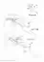 Fig. 09 - Cervical distraction/implant delivery device