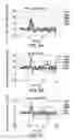 Fig. 07 - Systems and methods for fine motor control of fingers on a prosthetic hand to emulate a natural stroke
