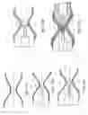 Fig. 08 - SYSTEMS AND METHODS FOR MAKING ENCAPSULATED HOURGLASS SHAPED STENTS