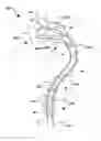 Fig. 01 - Vascular medical device, system and method