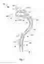 Fig. 02 - Vascular medical device, system and method