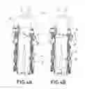 Fig. 07 - Exoskeleton for assisting human movement