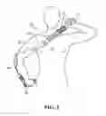 Fig. 03 - Swivelable massage device